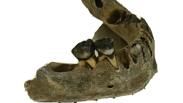 La sorpresa de Arealonga: restos humanos hallados en el yacimiento barreirense tienen más de 3.000 años