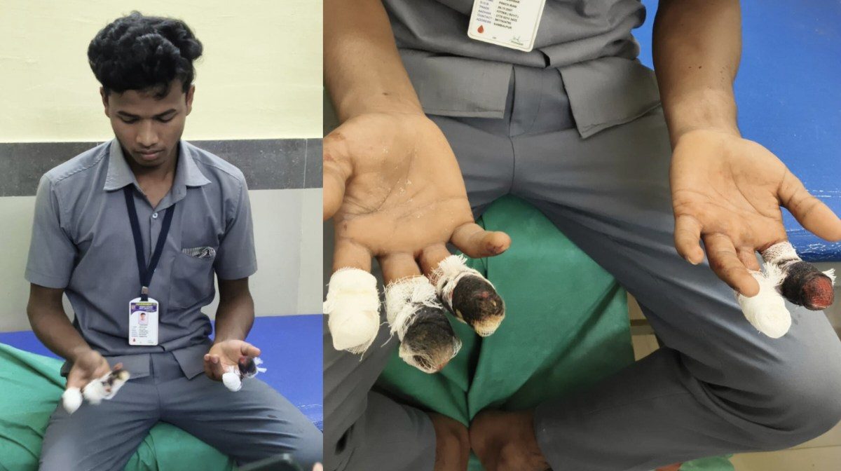 आईटीआई में पढ़ाई छोड़ छात्रों से मजदूरी, निर्माण कार्य के दौरान छात्र घायल हादसे में दोनों हाथों की पांच उंगलियां कटीं, छात्रों ने वर्षों से श्रम कराने का लगाया आरोप