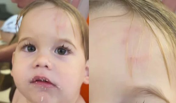 Virgínia Fonseca expõe machucado do filho após mordida na escola