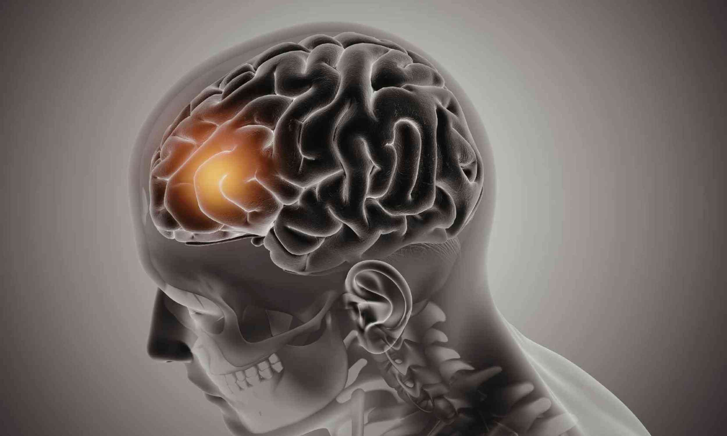 Scientists reprogram brain cells to target Alzheimer’s plaques with one injection